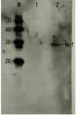 Anti-HIV1 Nef antibody used in Western Blot (WB). GTX64124