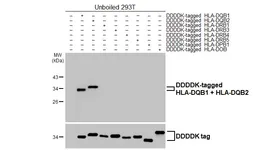 Anti-HLA-DQB1 + HLA-DQB2 antibody [HL3409] used in Western Blot (WB). GTX641246