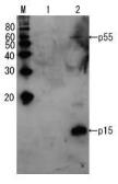 Anti-HIV1 p15 antibody used in Western Blot (WB). GTX64125