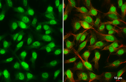 Anti-Rad21 antibody [HL3416] used in Immunocytochemistry/ Immunofluorescence (ICC/IF). GTX641258