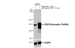 Anti-EGFR (phospho Thr669) antibody [HL3425] used in Western Blot (WB). GTX641267