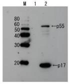 Anti-HIV1 p17 antibody used in Western Blot (WB). GTX64127