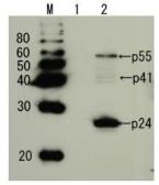 Anti-HIV1 p24 antibody used in Western Blot (WB). GTX64129