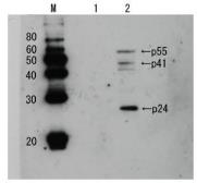 Anti-HIV1 p24 antibody (Biotin) used in Western Blot (WB). GTX64130