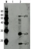 Anti-HIV1 p55 antibody used in Western Blot (WB). GTX64131