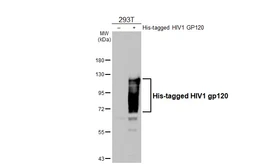 Anti-HIV1 gp120 antibody [GT45] used in Western Blot (WB). GTX641330
