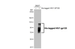 Anti-HIV1 gp120 antibody [GT46] used in Western Blot (WB). GTX641331