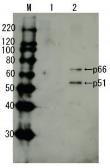 Anti-HIV1 Reverse transcriptase antibody used in Western Blot (WB). GTX64134
