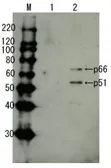 Anti-HIV1 Reverse transcriptase antibody used in Western Blot (WB). GTX64134