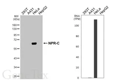 Anti-NPR-C antibody [HL3462] used in Western Blot (WB). GTX641347