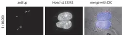 Anti-Legionella pneumophila antibody used in Immunocytochemistry/ Immunofluorescence (ICC/IF). GTX64135