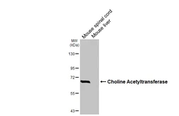 Anti-Choline Acetyltransferase antibody [HL3466] used in Western Blot (WB). GTX641351