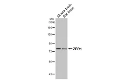 Anti-ZER1 antibody [HL3491] used in Western Blot (WB). GTX641379