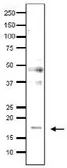 Anti-Med9 / Cse2 (S. cerevisiae) antibody used in Western Blot (WB). GTX64138