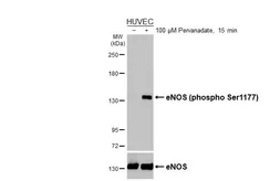 Anti-eNOS (phospho Ser1177) antibody [HL3498] used in Western Blot (WB). GTX641386