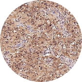 Anti-mGluR5 antibody [H339] HistoMAX&trade; used in IHC (Paraffin sections) (IHC-P). GTX641400