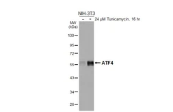 Anti-ATF4 antibody [HL3514] used in Western Blot (WB). GTX641411