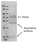 Anti-Nob1 (S. cerevisiae) antibody used in Western Blot (WB). GTX64142