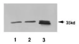 Anti-Pad1 (S. pombe) antibody used in Western Blot (WB). GTX64143