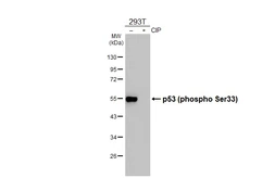 Anti-p53 (phospho Ser33) antibody [HL3559] used in Western Blot (WB). GTX641465