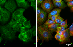 Anti-GPR120 antibody [HL3563] used in Immunocytochemistry/ Immunofluorescence (ICC/IF). GTX641469