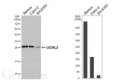 Anti-UCHL3 antibody [HL3564] used in Western Blot (WB). GTX641470