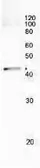 Anti-RecA antibody used in Immunoprecipitation (IP). GTX64150