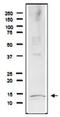 Anti-Rfa3 / Rpa3 (S. cerevisiae) antibody used in Western Blot (WB). GTX64152