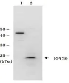 Anti-RPC19 (S. cerevisiae) antibody used in Western Blot (WB). GTX64155