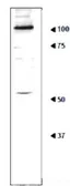 Anti-Ribophorin I (S. cerevisiae) antibody used in Western Blot (WB). GTX64156
