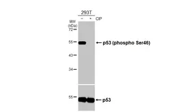 Anti-p53 (phospho Ser46) antibody [HL3589] used in Western Blot (WB). GTX641560