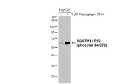 Anti-SQSTM1 / P62 (phospho Ser272) antibody [HL3591] used in Western Blot (WB). GTX641562