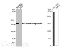 Anti-Thrombospondin 1 antibody [HL3593] used in Western Blot (WB). GTX641564