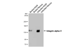 Anti-Integrin alpha V antibody [HL3598] used in Western Blot (WB). GTX641573