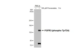 Anti-FGFR3 (phospho Tyr724) antibody [HL3612] used in Western Blot (WB). GTX641587