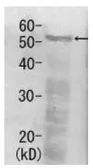 Anti-Rpn5 (S. cerevisiae) antibody used in Western Blot (WB). GTX64159