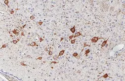 Anti-Choline Acetyltransferase antibody [HL3617] used in IHC (Paraffin sections) (IHC-P). GTX641592