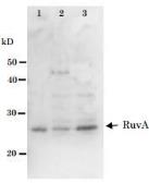 Anti-RuvA antibody used in Western Blot (WB). GTX64162