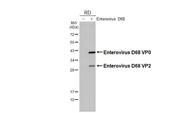 Anti-Enterovirus D68 VP2 antibody [HL3641] used in Western Blot (WB). GTX641632