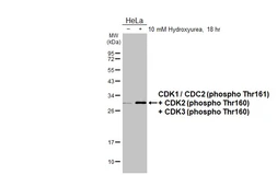 Anti-CDK1 / CDC2 (phospho Thr161) + CDK2 (phospho Thr160) + CDK3 (phospho Thr160) antibody [HL3648] used in Western Blot (WB). GTX641639