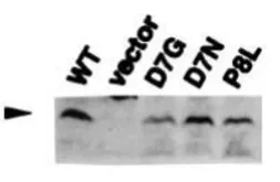 Anti-RuvC antibody used in Western Blot (WB). GTX64164