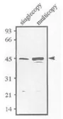 Anti-Sds23 (S. pombe) antibody used in Western Blot (WB). GTX64166