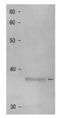 Anti-Shugoshin 1 (S. pombe) antibody used in Western Blot (WB). GTX64167