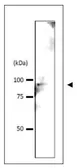 Anti-Srb4 (S. cerevisiae) antibody used in Western Blot (WB). GTX64169