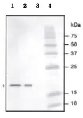 Anti-Streptococcus NADase Inhibitor antibody used in Western Blot (WB). GTX64170