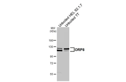 Anti-ORP8 antibody [HL3673] used in Western Blot (WB). GTX641701