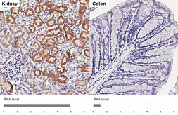 Anti-ORP8 antibody [HL3673] used in IHC (Paraffin sections) (IHC-P). GTX641701