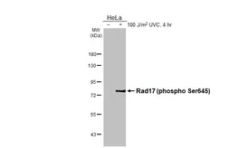 Anti-Rad17 (phospho Ser645) antibody [HL3676] used in Western Blot (WB). GTX641704