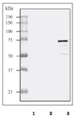 Anti-Streptolysin O antibody used in Western Blot (WB). GTX64171