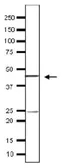 Anti-Taf11 (S. cerevisiae) antibody used in Western Blot (WB). GTX64176